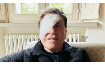 Gianni Morandi, mistero sulla foto sui social con una benda sull’occhio. Lui:“Ho fatto a pugni”
