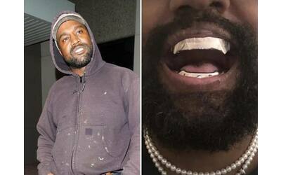 kanye west come jaws il cattivo di james bond il rapper si fatto fare una protesi dentale al titanio da 850 000 dollari