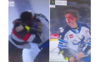 hockey rissa e scazzottata il viso di bauer una maschera di sangue