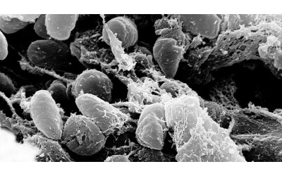 Stati Uniti, identificato un caso di peste bubbonica: probabile contagio da...