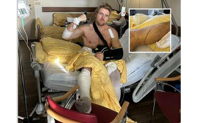 Aleksander Kilde come sta: «Non riesco a muovere le dita del piede dopo incidente di Wengen»