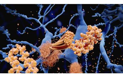 Alzheimer, la speranza in un gene «Crea una barriera nel cervello»