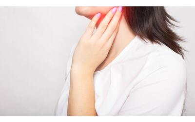 Calcoli nelle ghiandole salivari: che cosa sono e perché possono provocare vere coliche locali