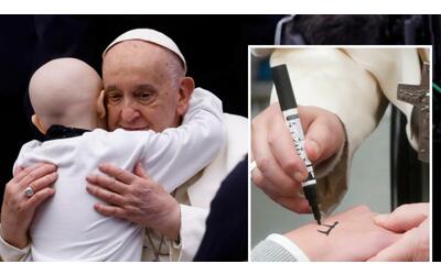 Il Papa con i pazienti del Bambino Gesù: «Le cure non siano privilegio». Gli abbracci e l'autografo sulle mani