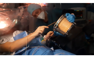 Il paziente suona la batteria mentre una squadra di chirurghi lo opera al...