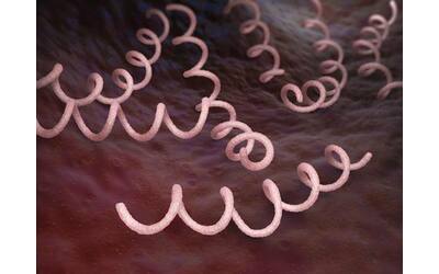 Sifilide, casi in aumento in Italia e nel resto del mondo. Come proteggersi e curarla