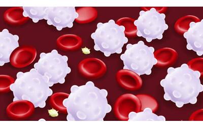 Tumori del sangue, nuova terapia a durata fissa per la leucemia linfatica cronica