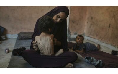 “A Gaza il 25% di bimbi e madri è malnutrito. E i piccoli, affamati e stremati, smettono di piangere”