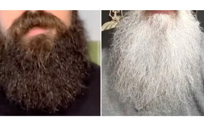 “Attenzione, la barba è un covo di germi: ci sono più batteri che nel water e si possono trasmettere anche dopo averla lavata”: gli studi