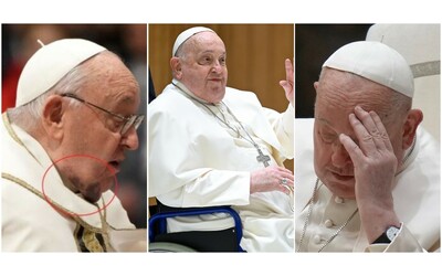 Come sta Papa Francesco? Dalla bronchite alle recenti cadute: ecco le condizioni di Bergoglio