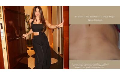 Cos il body contouring il trattamento per assottigliare il punto vita fatto da Chanel Totti Rischio di emualzione delle coetanee di solito lo fa chi ha problemi di lassit cutanea