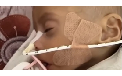 Gaza, Zainab Abu Halib morta a 6 mesi per malnutrizione: “Pesava 2 kg invece di 5”