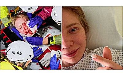 Guarder questa foto e ricorder che sono stata pi forte di quanto credessi la prima foto di Sellier dopo il taglio al volto