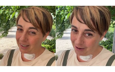 “Ho ancora la voce bassa e raucedine. Mi sono annoiata di stare a casa senza fare niente”: Benedetta Rossi aggiorna i fan dopo l’operazione alla tiroide