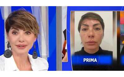 Ho fatto la blefaroplastica e mi hanno riempita di insulti Mi hanno scritto sei un mostro poveri figli ma non mi vergogno Sono vanitosa e voglio farne gi un altra cos Ilaria Galassi