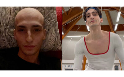 Ho sentito un pallino sul petto era una massa tumorale di 11 centimetri Sono scoppiato a piangere l incredibile storia del ballerino Francesco Piccinin