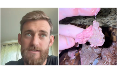 “Ho trovato una sostanza strana sulla mia fetta di carne. Era chewing gum. Qualcuno mi deve dare delle spiegazioni”: lo choc di Jordan Colleary – VIDEO