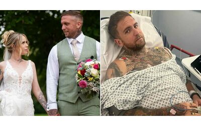“I medici dicevano che ero stressato per il matrimonio, invece avevo un cancro al colon al quarto stadio grande quanto un’arancia”: la storia di Ashley e l’analisi dell’esperto