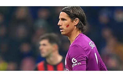 Inter Sommer diventato un problema la differenza con le big sta tutta in porta