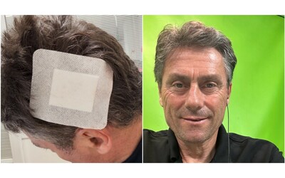 Investito da un auto non assicurata ho saltato sul cofano e stupito i medici C una maleducazione imperante e intollerabile lo sfogo di Silvio Martinello