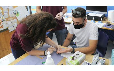 L AIDS esiste ancora e in Italia il 60 delle nuove diagnosi arriva tardi Serve una prevenzione continua Gli eterosessuali Non percepiscono abbastanza il rischio