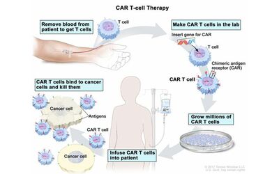 L’immunoterapia anti tumorale Car-T: una promessa per i pazienti, una sfida per il servizio sanitario