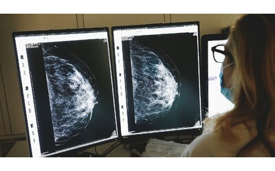 La dieta mima digiuno e il desametasone potenziano le terapie nel trattamento del tumore al seno