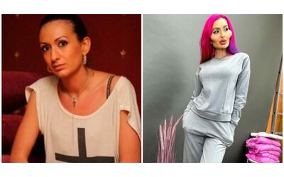 La donna con le guance più grandi al mondo stupisce i suoi fan: Anastasia Pokreshchuk pubblica una foto del suo volto prima della chirurgia estetica