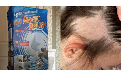 “La spazzola comprata su Temu si è accesa da sola, è volata via e le ha risucchiato i capelli. Ora mia figlia di 3 anni ha una grossa chiazza calva”: la rabbia della mamma