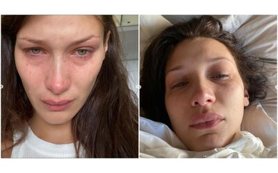 “Le batterie del mio corpo non si ricaricano mai”: Bella Hadid torna a parlare della sua battaglia contro la malattia di Lyme