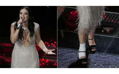 “Mi attaccano la scarpa al piede con lo scotch”: Francesca Michielin e il ‘trucco’ per stare sul palco senza stampelle dopo la caduta
