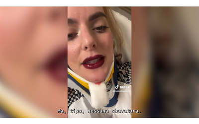 “Mi sono schiantata con la bici ma il mio rossetto è ancora perfetto”: il video della tiktoker dall’ospedale fa discutere