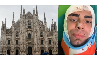 Rapina a Milano, 25enne aggredito con un martello: “Mi hanno spaccato la testa per un orologio di m…”