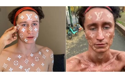 Si abbronza lasciando i loghi di Louis Vuitton sulla pelle: il tutorial per una tintarella griffata diventa virale – VIDEO