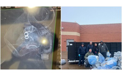 Si toglie i preziosi anelli di famiglia per fare la radiografia e poi li perde: tutto l’ospedale si mobilita e passa ai raggi X la spazzatura per ritrovarli