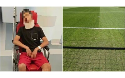 Squalifica di un anno per il portiere 13enne picchiato dal genitore di un avversario