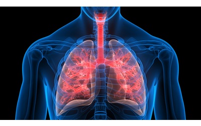 Fibrosi cistica: un nuovo passo avanti nella lotta contro le infezioni