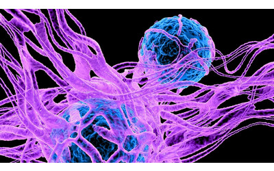 Indagato un possibile legame tra serotonina e cellule tumorali
