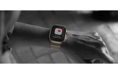 Notifiche sull'ipertensione su diversi Apple Watch, non solo sugli ultimi. Ma in Italia?