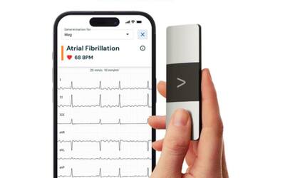Come un dottore in casa: la macchina smart per ECG wireless per smartphone