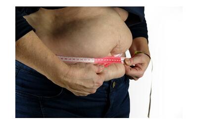 In vent’anni +1,6 milioni di obesi in Italia